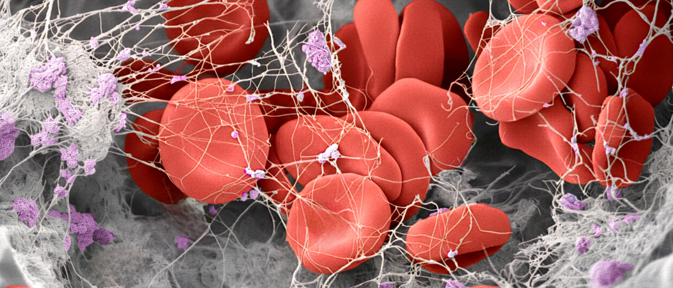 Showcasing Iowa’s 2025 Research Photo Contest Winners Across Campus