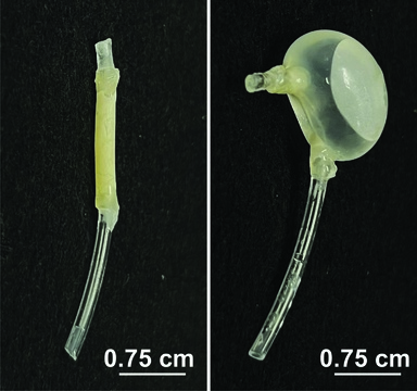 DRIFT device offers less invasive bladder cancer treatment alternative