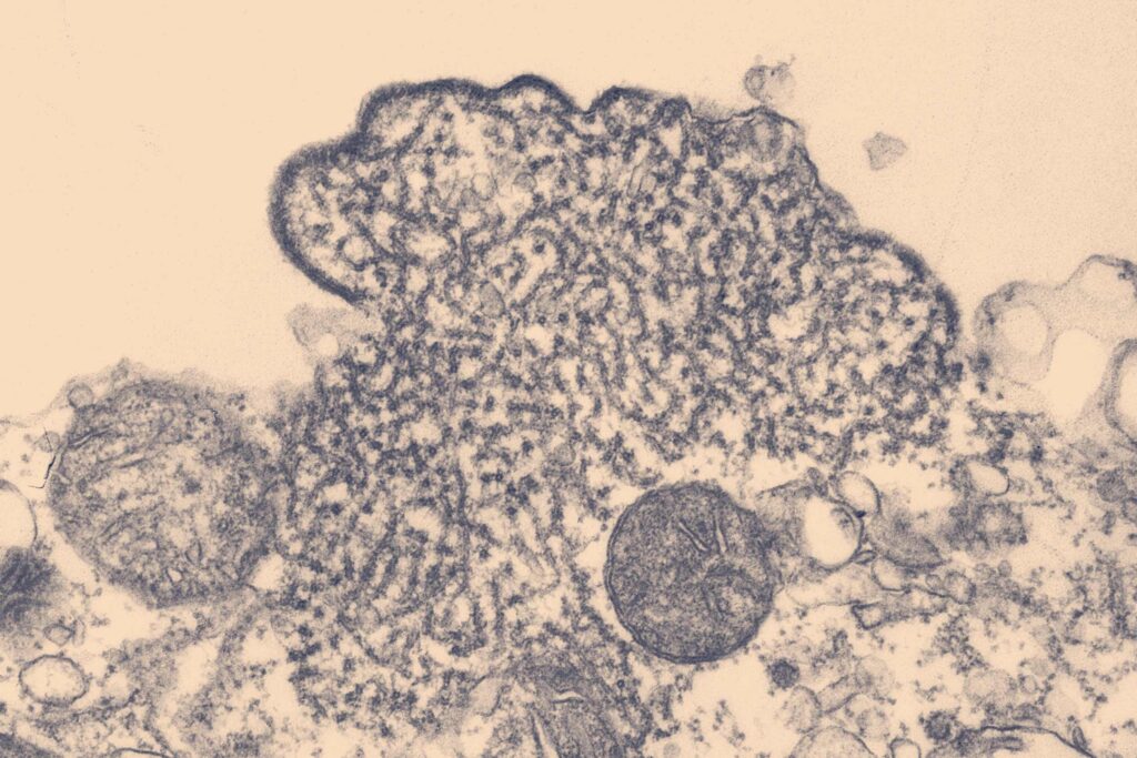 Nipah Virus Contained: No Vaccine, High Fatality, Global Precautions