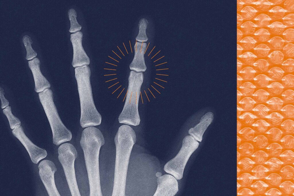 Understanding Joint Noises: Causes, Relief, and Exercise Guidance