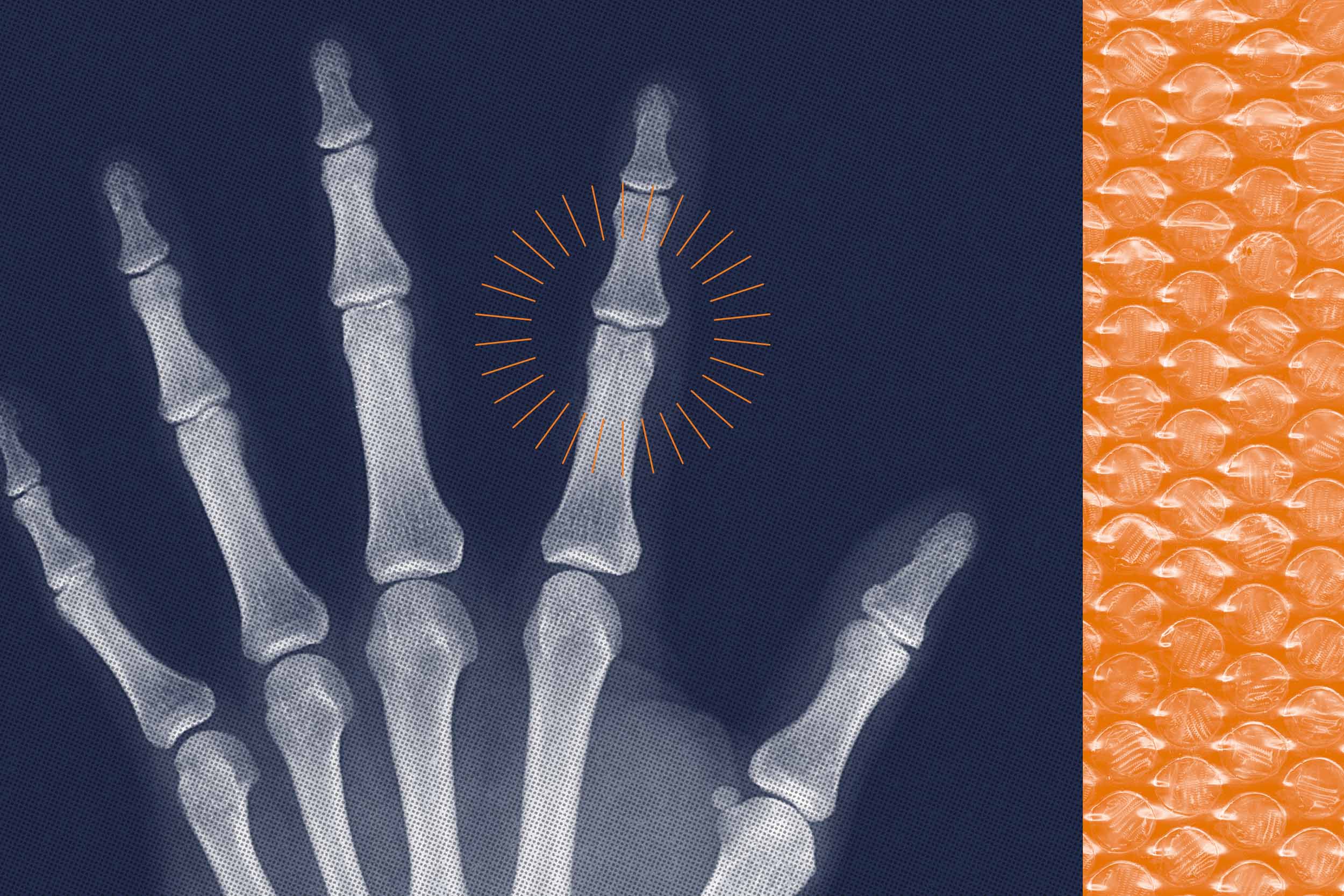 Understanding Joint Noises: Causes, Relief, and Exercise Guidance