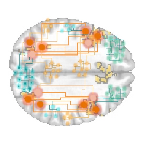 UIowa Study Reveals Brain’s Frontoparietal Cortex Decision-Making Role UIowa Study Reveals Brain’s Frontoparietal Cortex Decision-Making Role