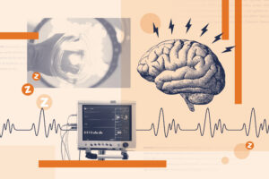 UVA Scientists Link Post-Surgery Delirium to Dementia, Suggest Drug Fix